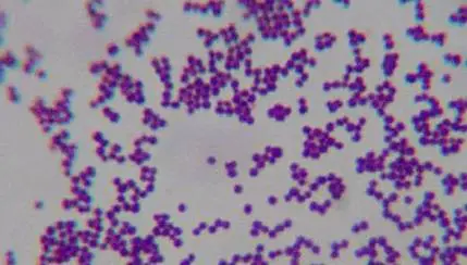 Relapse of Staphylococcus aureus bloodstream infection – patient  information sheet